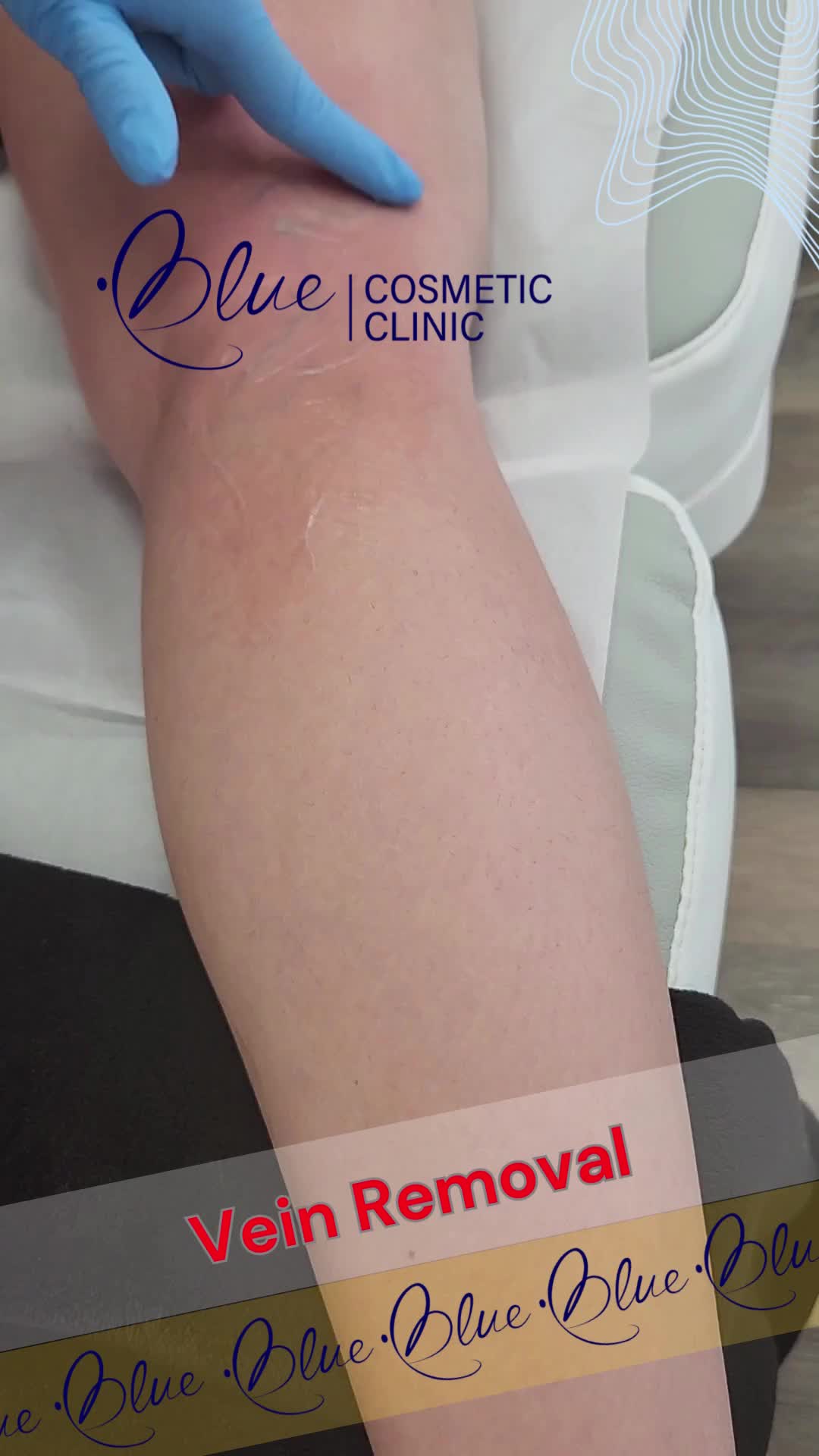 @BlueMedi.ca