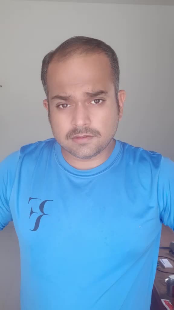 @Ragavendra Prasad