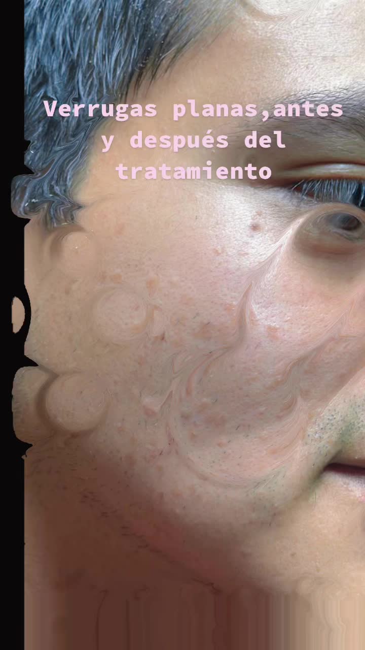 @Dra&ensp;Silvia&ensp;Lorena&ensp;FLORES&ensp;derma