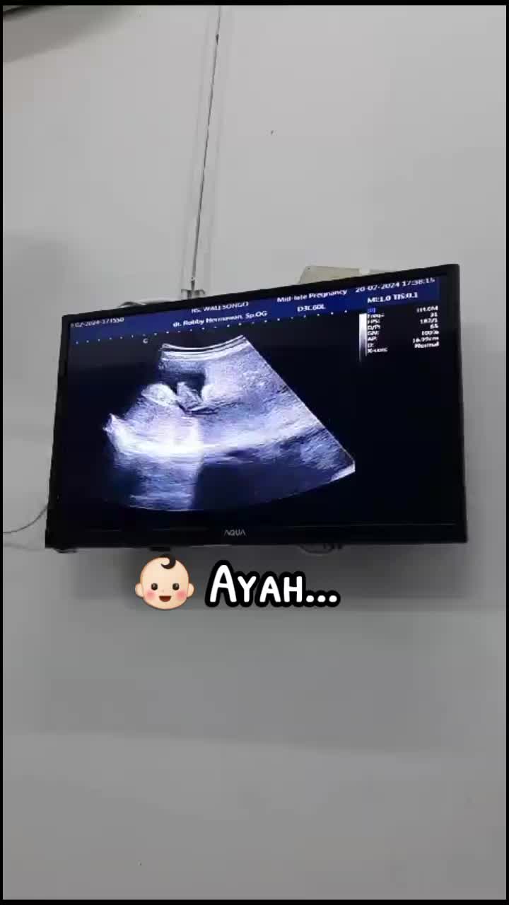 @Dew__