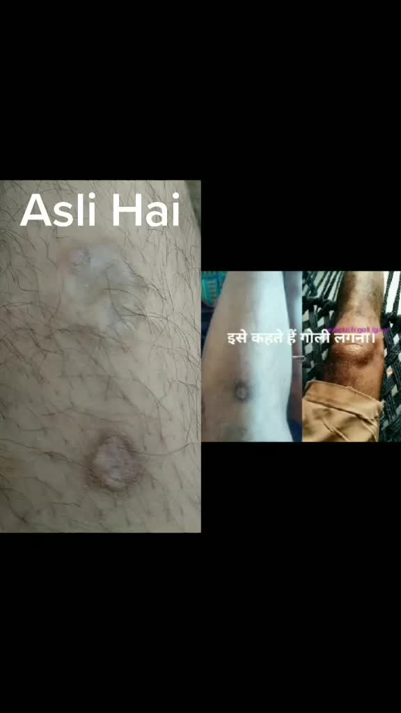 @Anas Malik