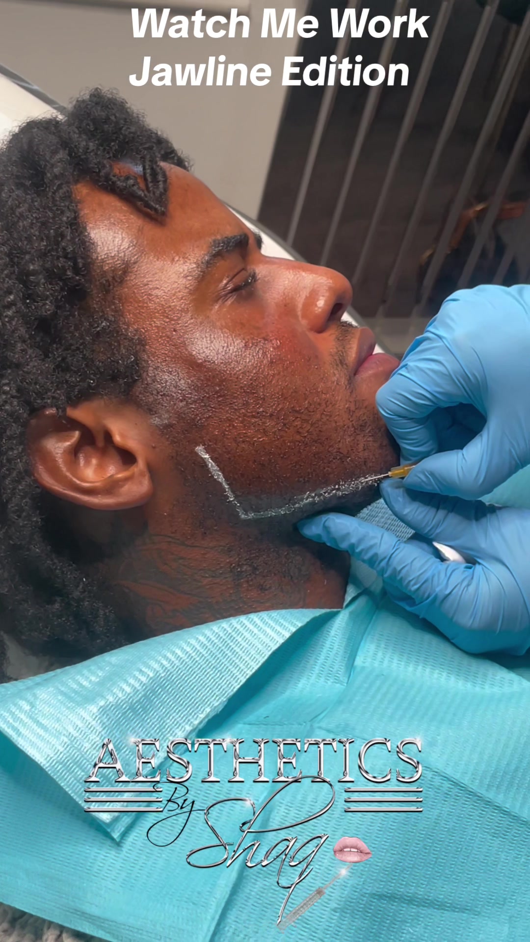 @Aestheticsbyshaq💉