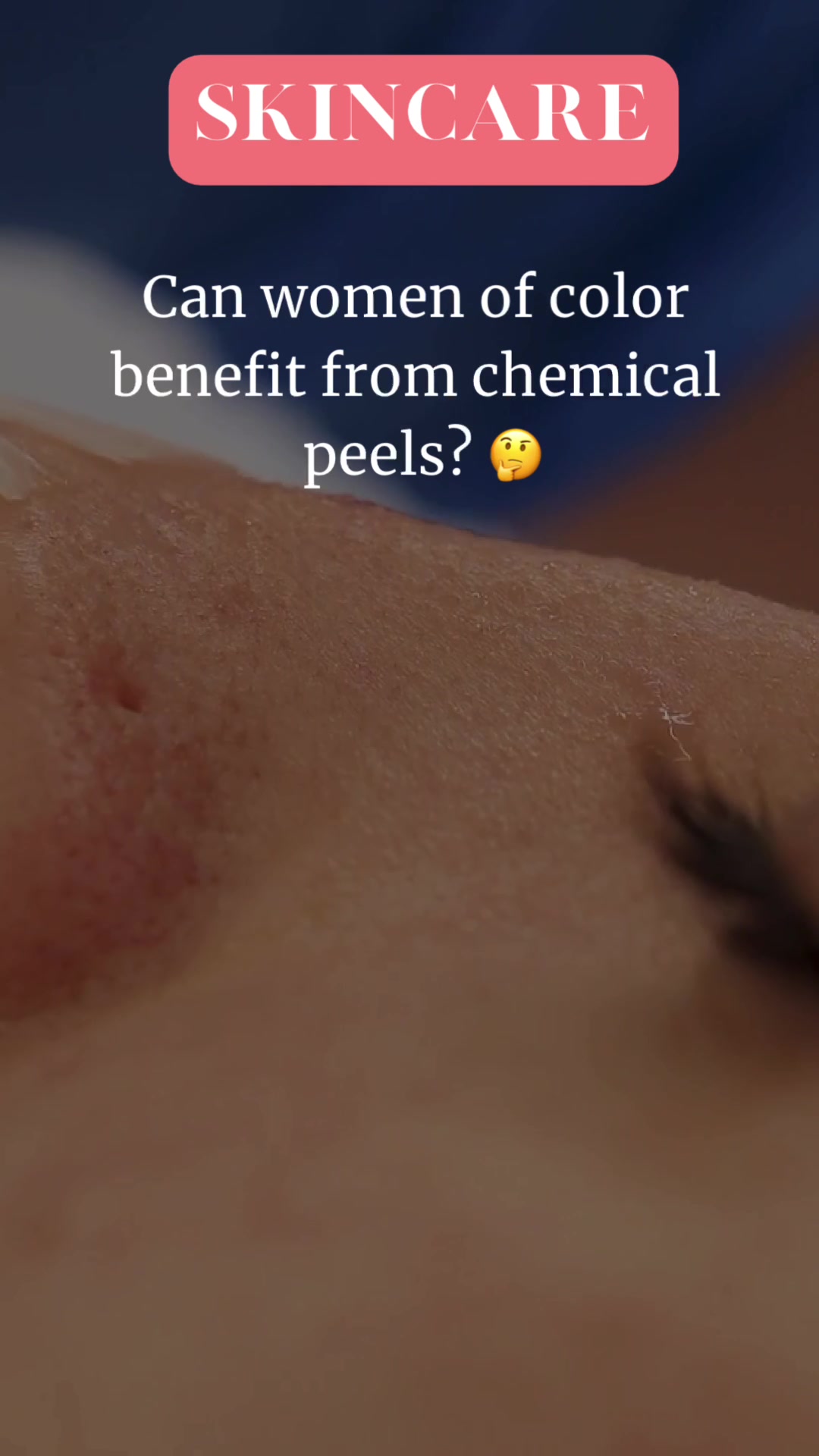 @Jolly | Beauty & Health Expert