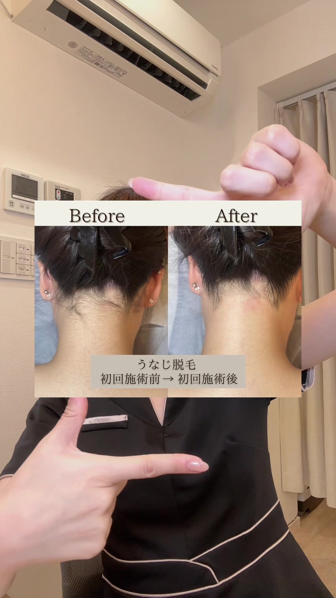 @ひな🐣/女性専用×脱毛専門店INVEST