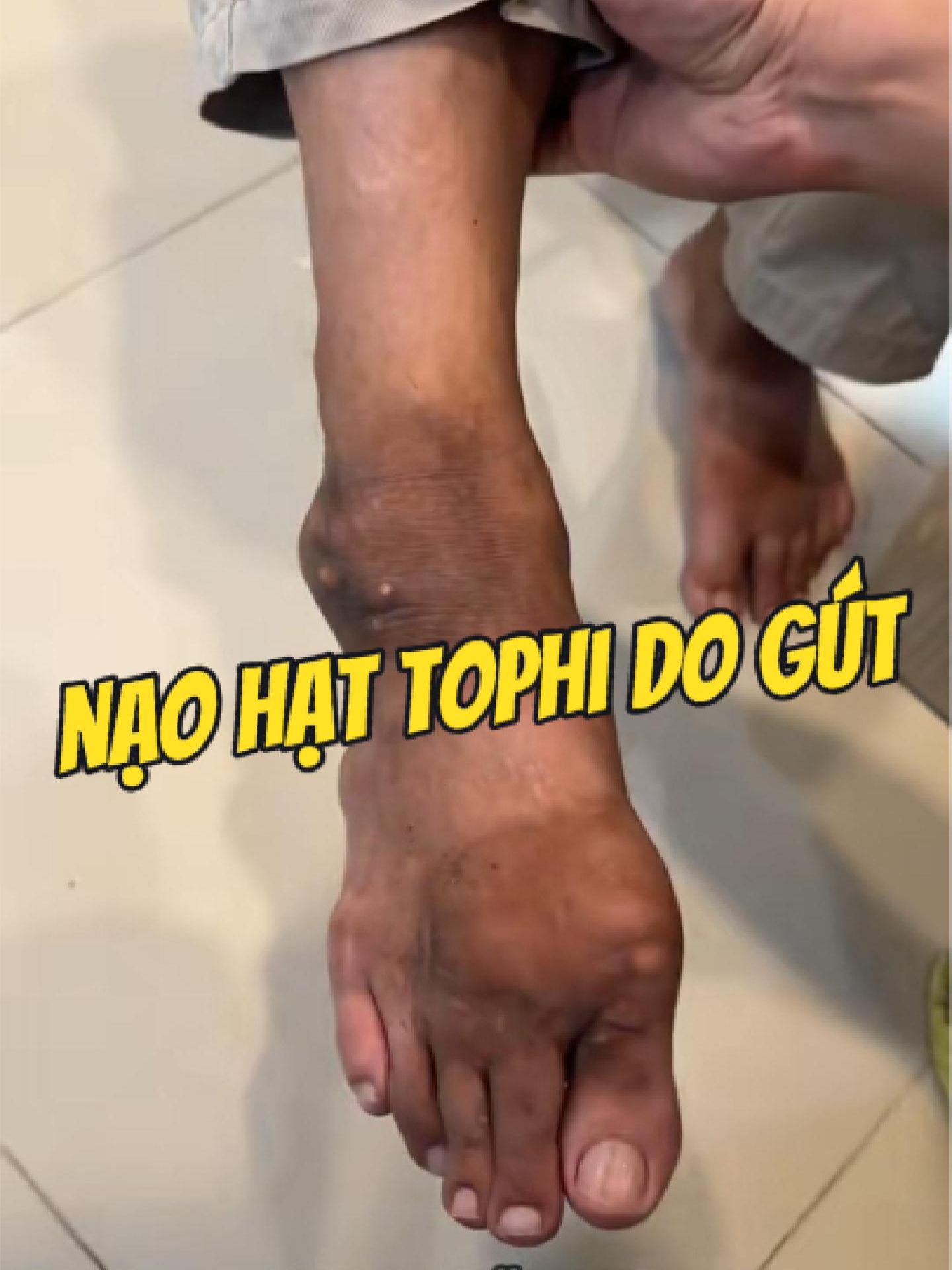 @Chuy&ecirc;n gia xương khớp