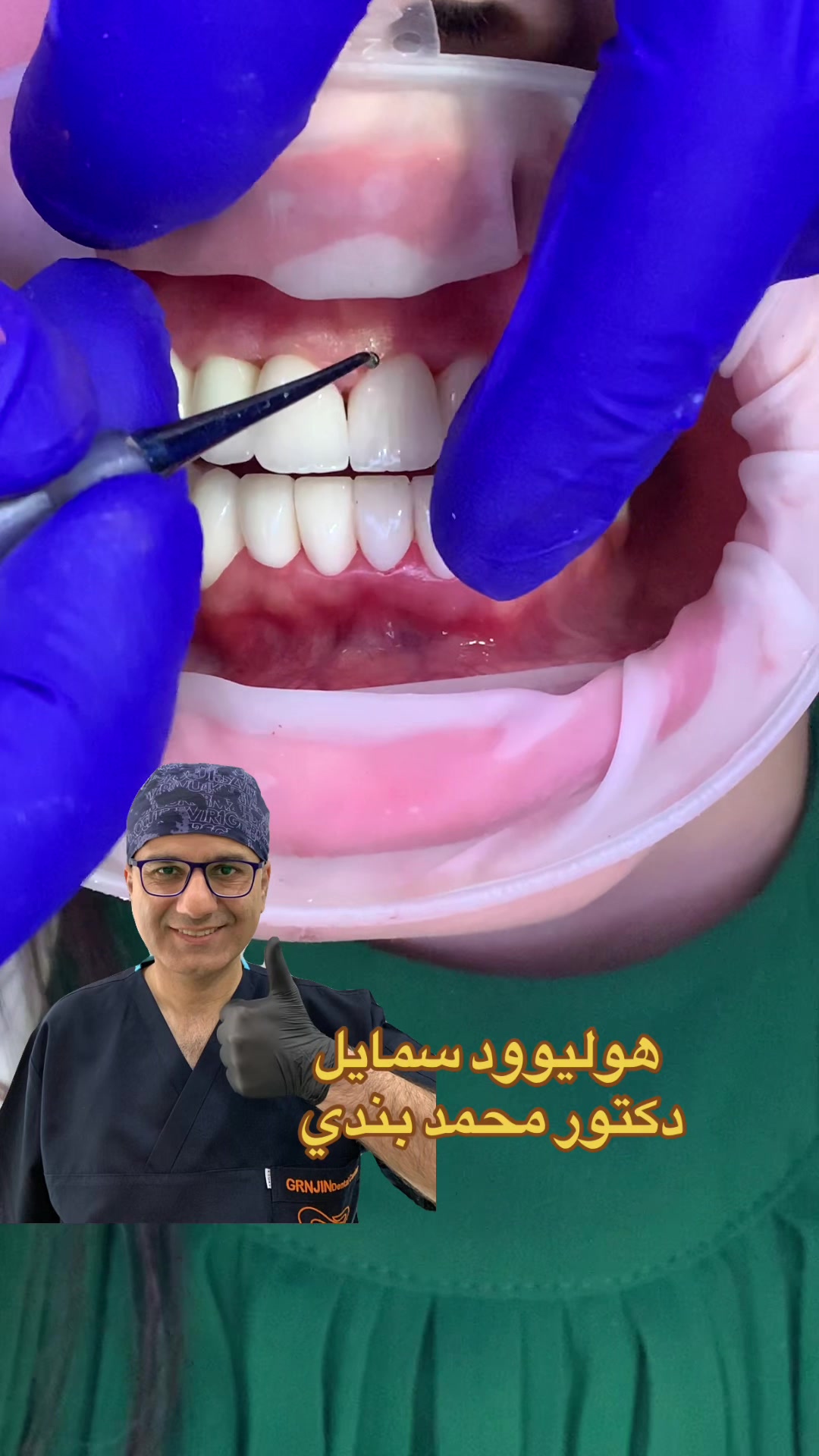 @Dr.Mohammed.Bandi