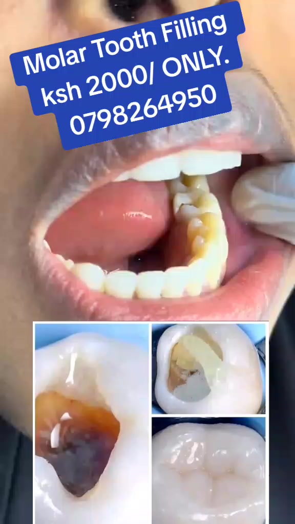 @MIRAHN DENTAL CARE