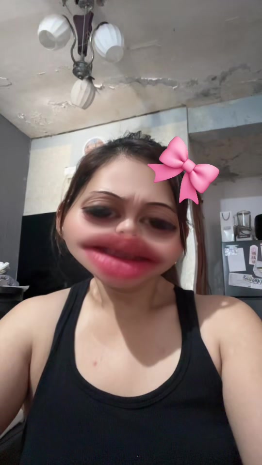 @Anapotz