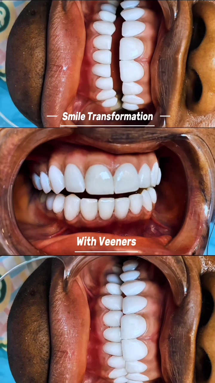 @Whiten Lighten TAC