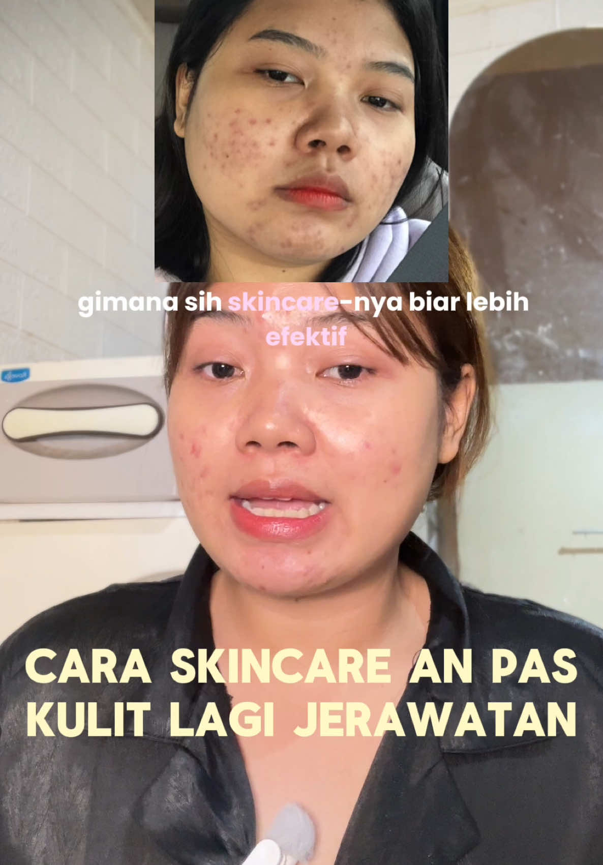 @ichi | glow up journey
