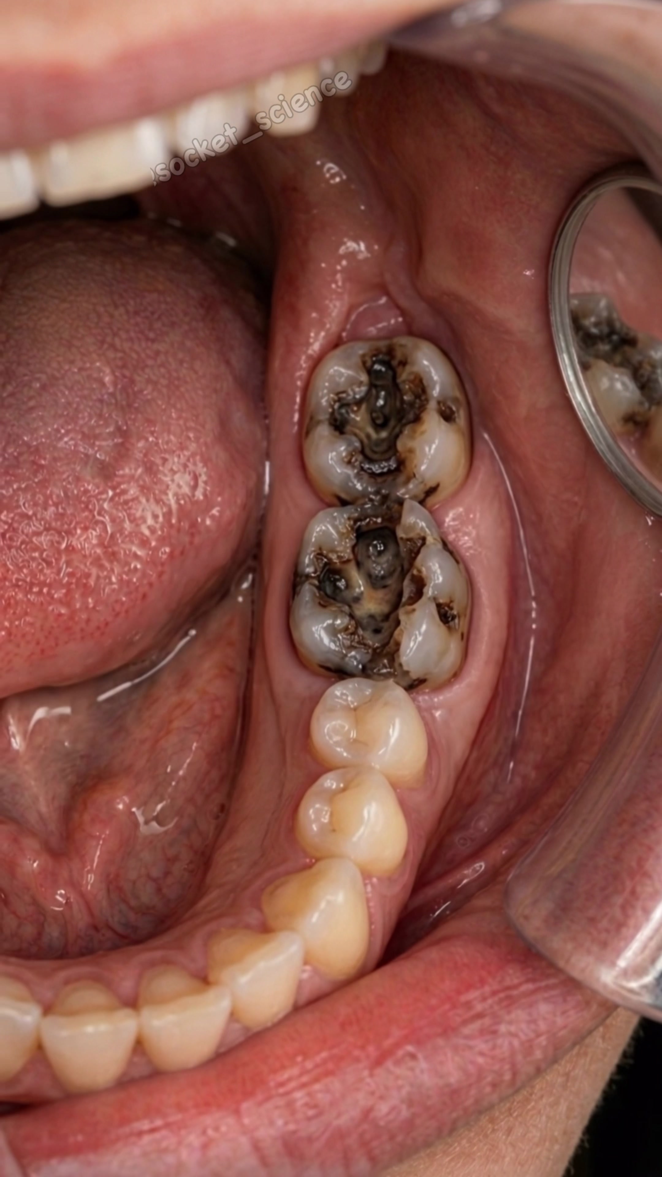 @Socket Science | Dental Visual