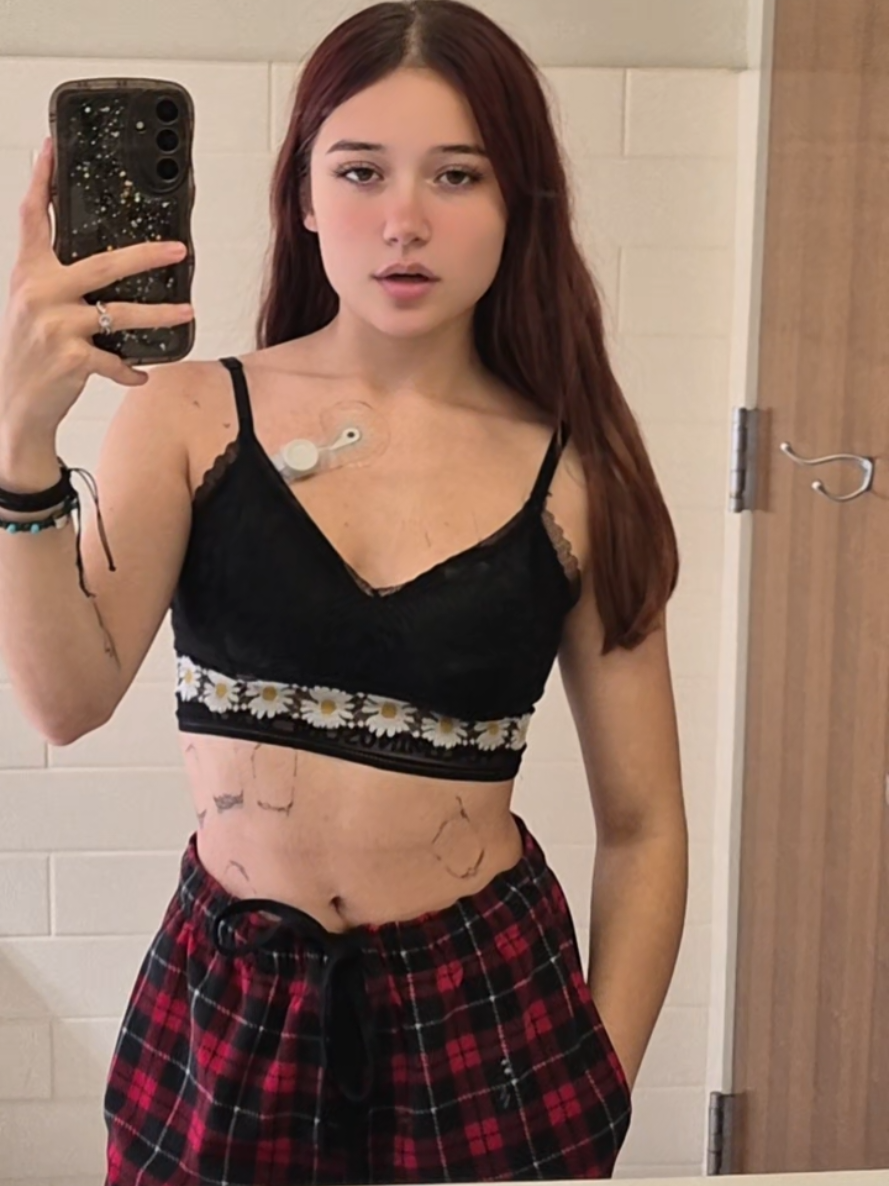 @A-M