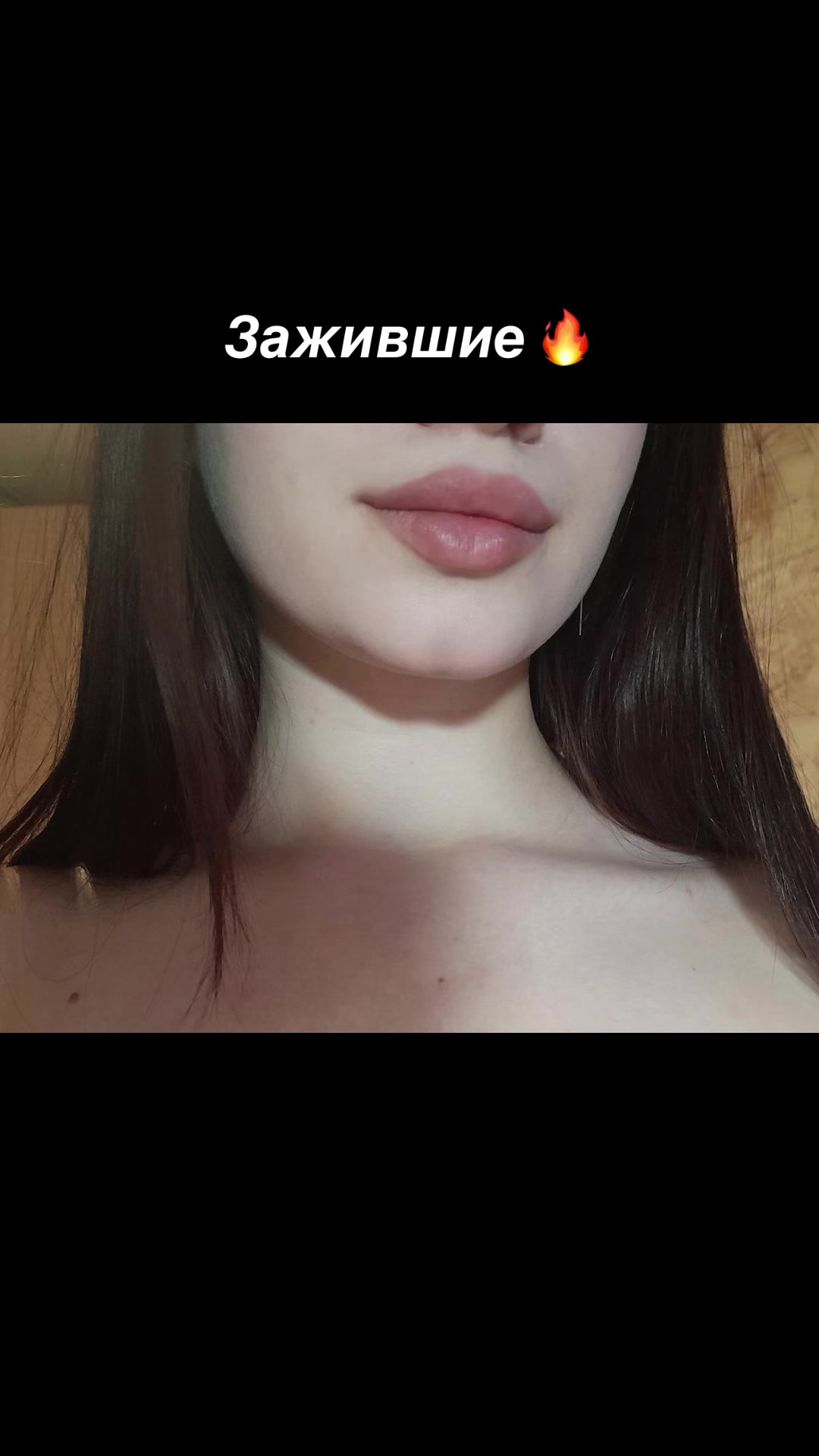 @КОСМЕТОЛОГ &bull; УВЕЛИЧЕНИЕ ГУБ