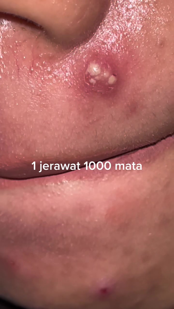 @Cottanish