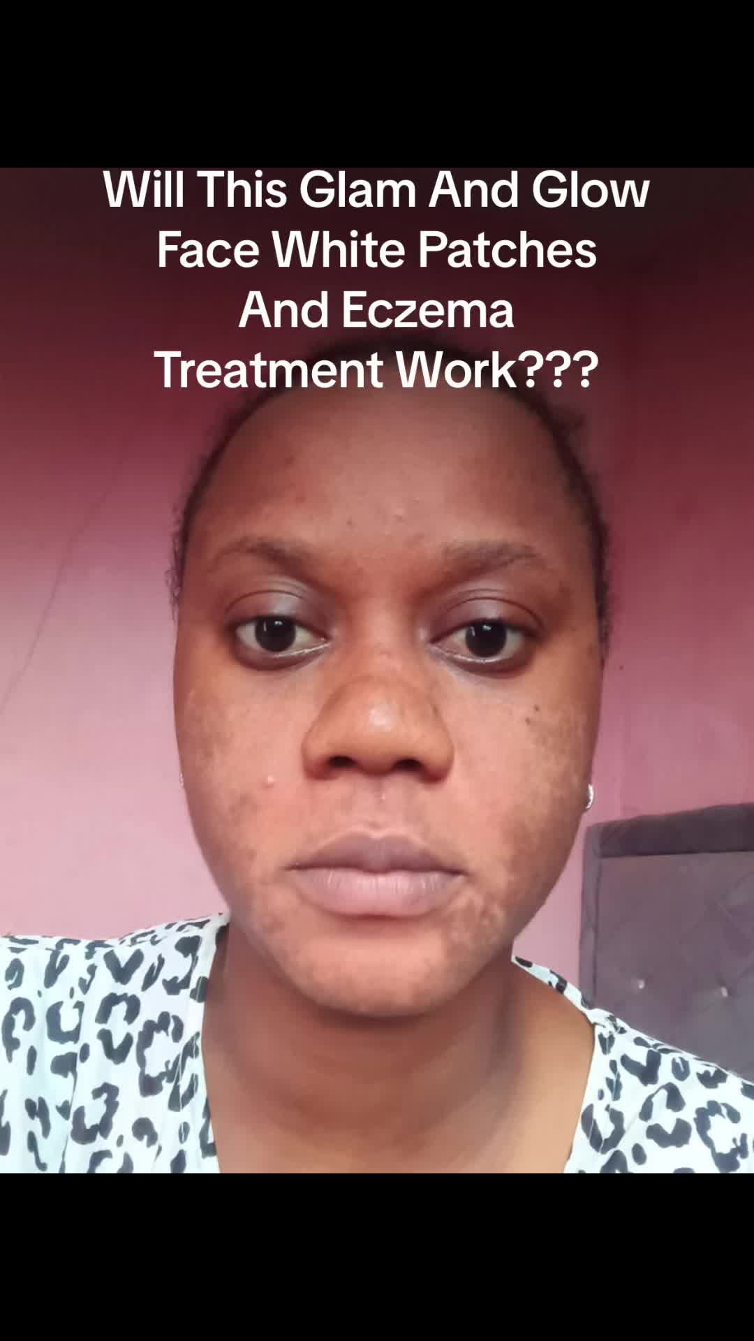 @SKIN REPAIR TREATMENT EXPERT