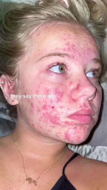 @e r i n