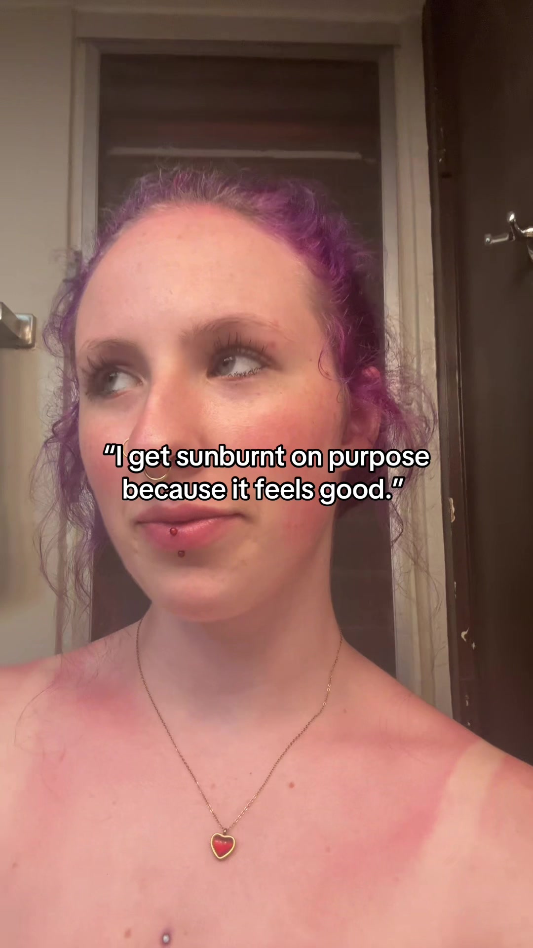 @Aurora