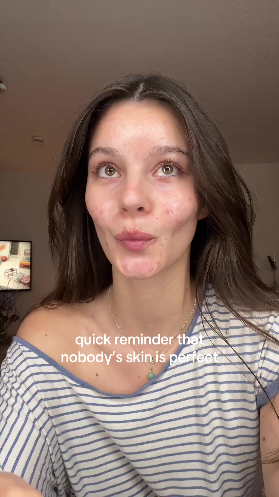 @Eliz Laetitia