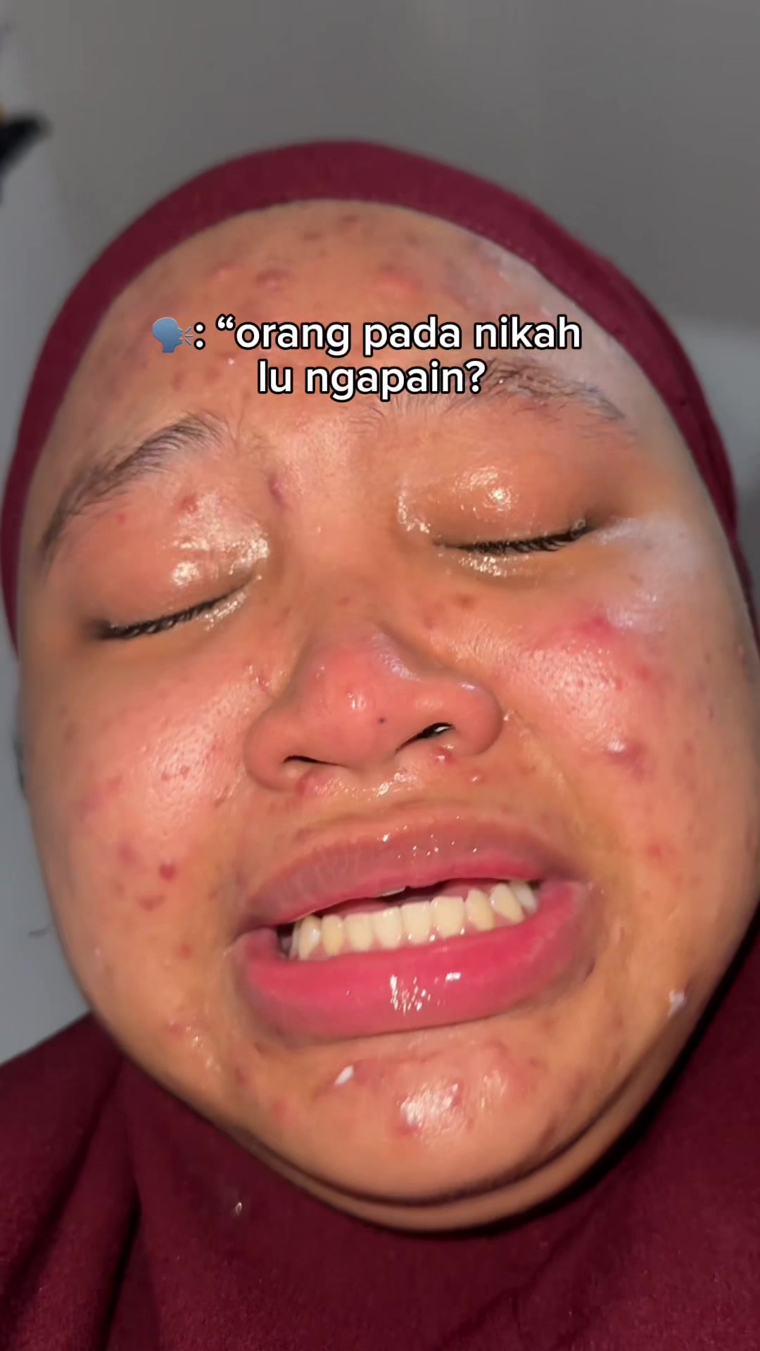 @MBAK CUNGCAT BAYI
