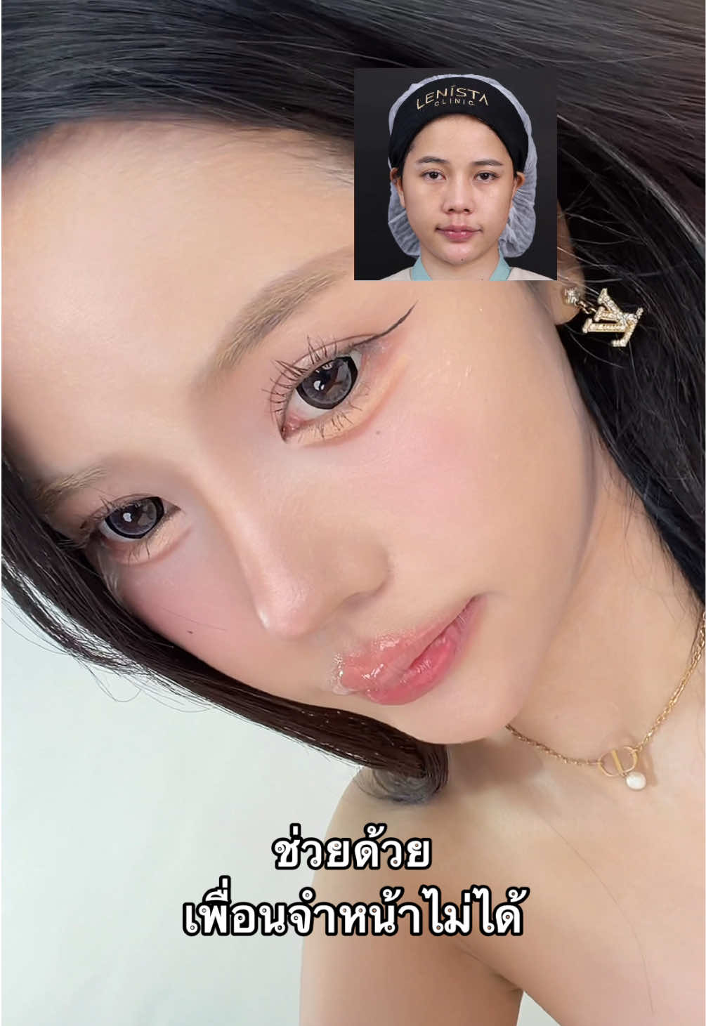 @หมอธัญ LENISTA