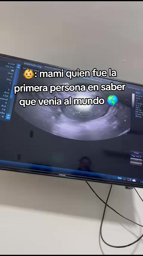 @Erika Santamaria 😛