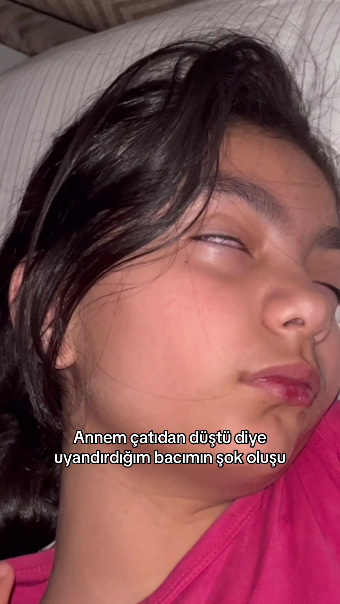 @BURAK &Uuml;NAL