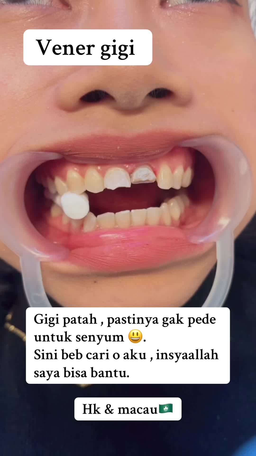 @mbak-Paijem