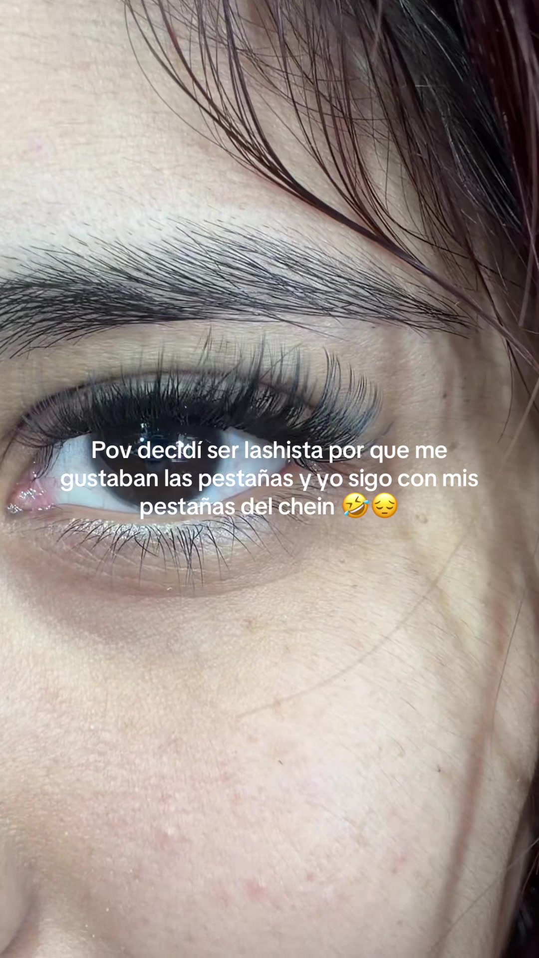 @Akarii MG