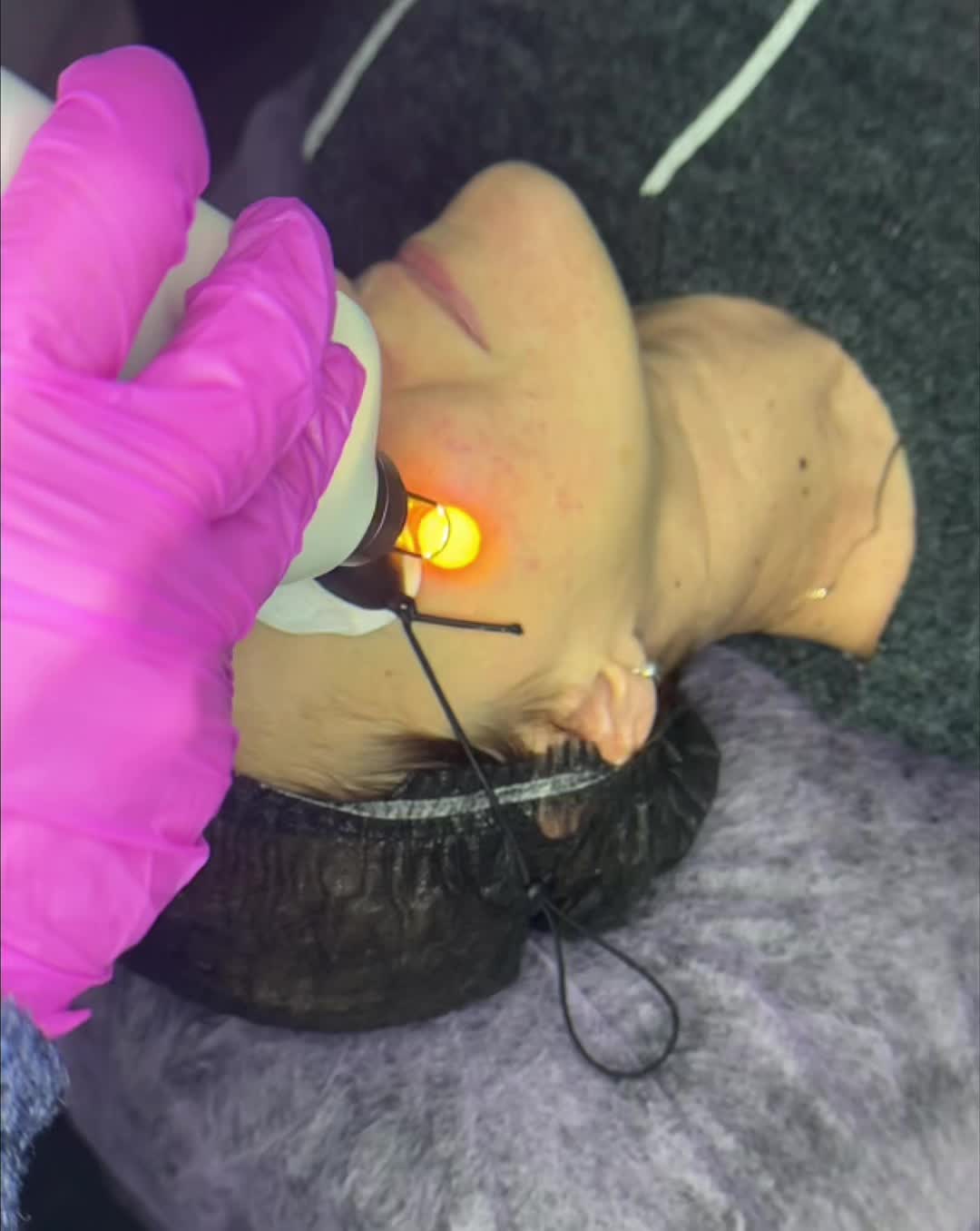 @Laser_Therapy.CARE
