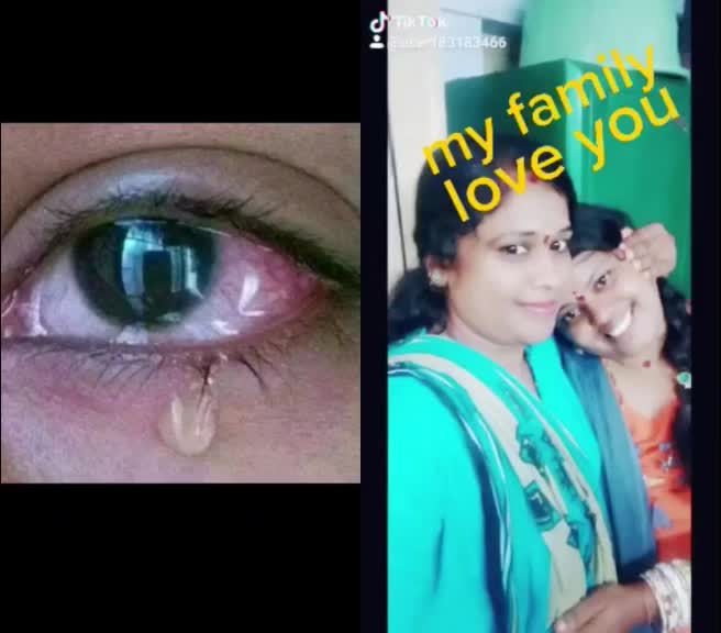 @Rameshbabu Babu