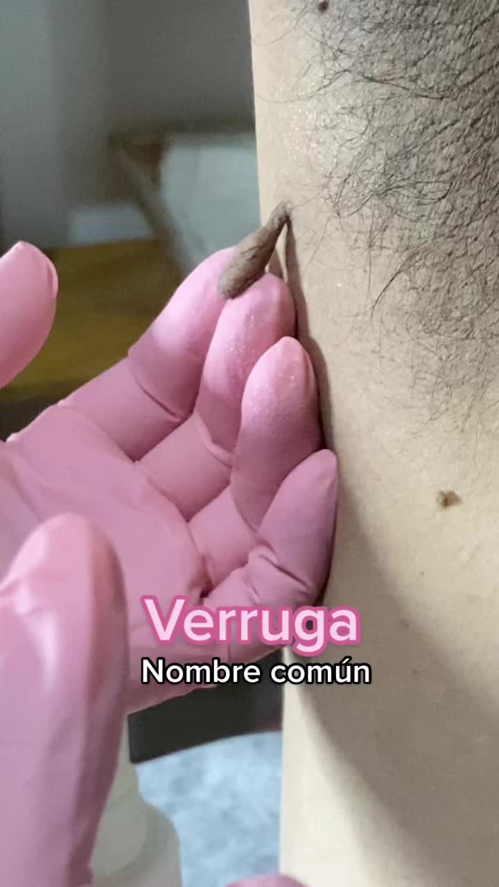 @C&eacute;lula SPA