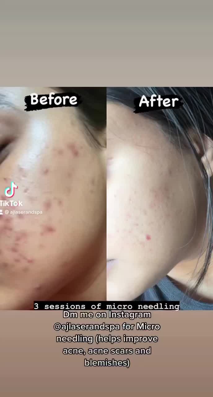 @ajlaserandspa