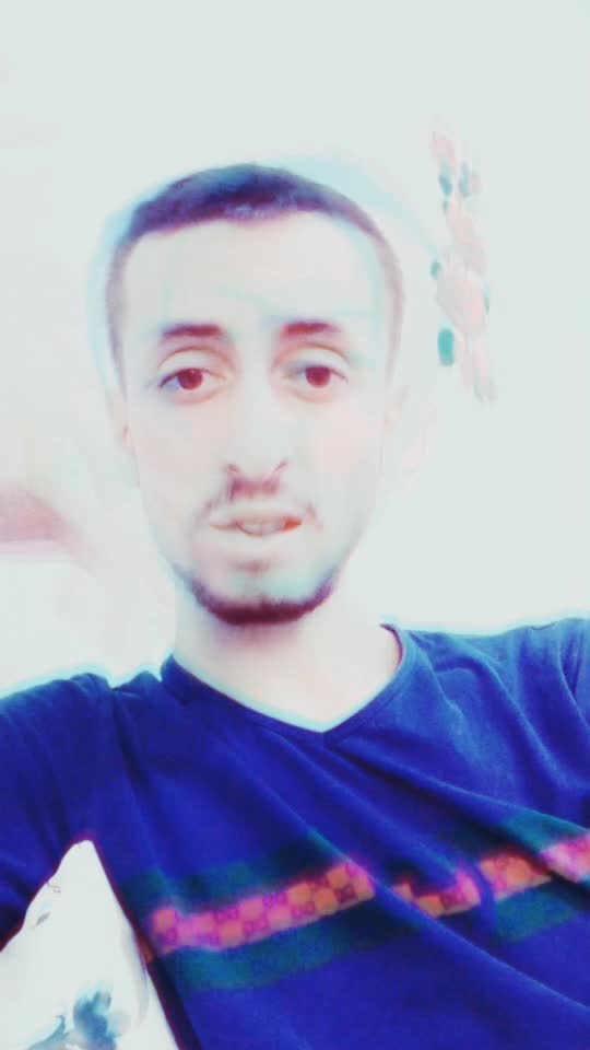 @Yunus dizlek