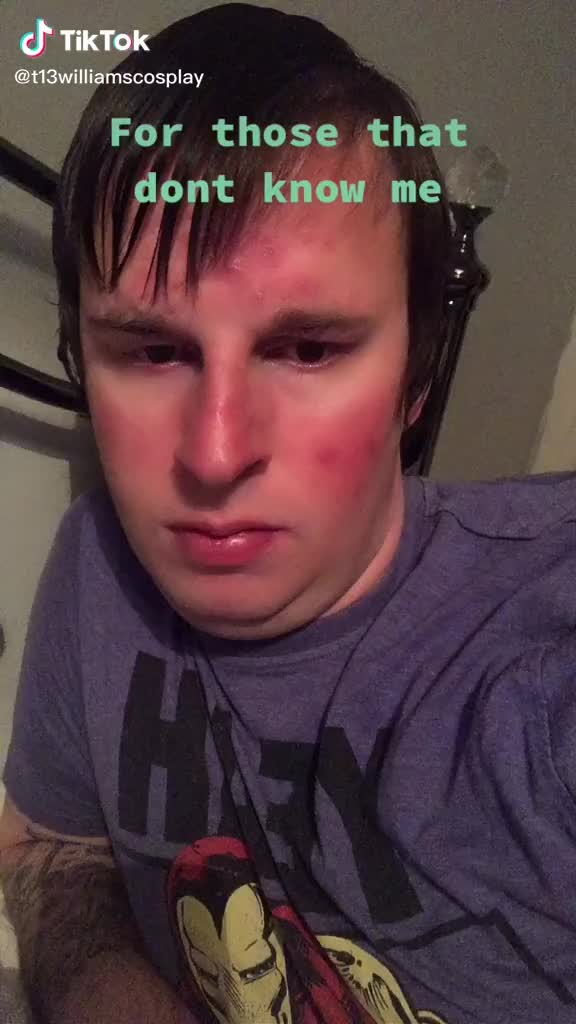 @My Red Skin