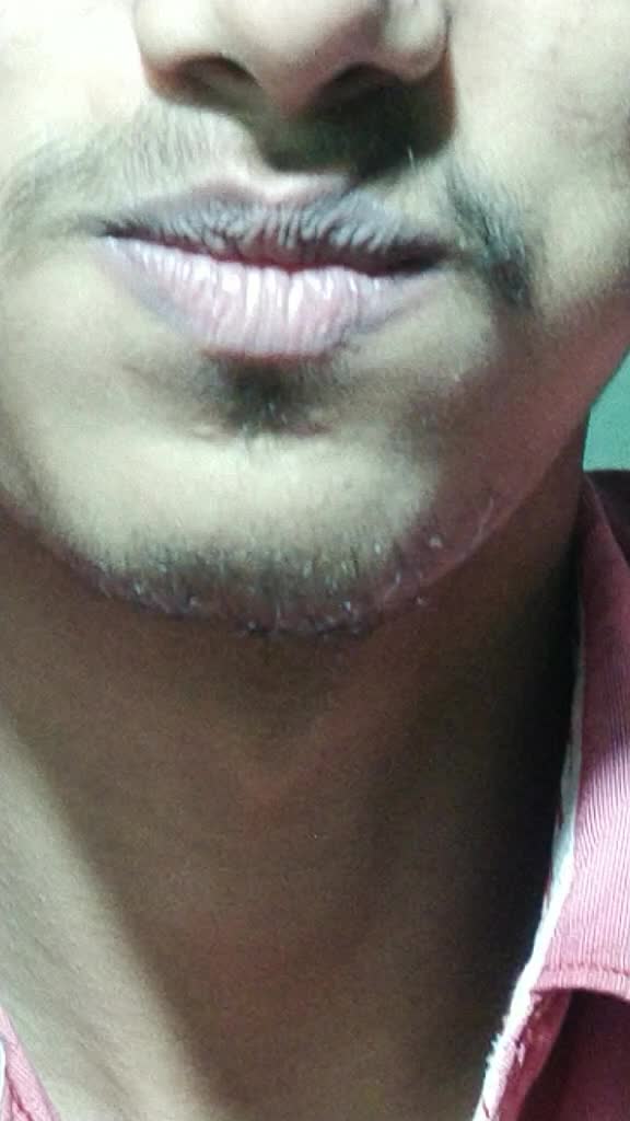 @Lips KingMaker 1