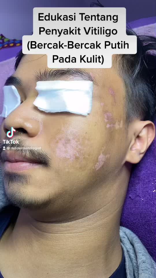 @Dr.dr.Hj.Ratna KD,SpDVE,MKes