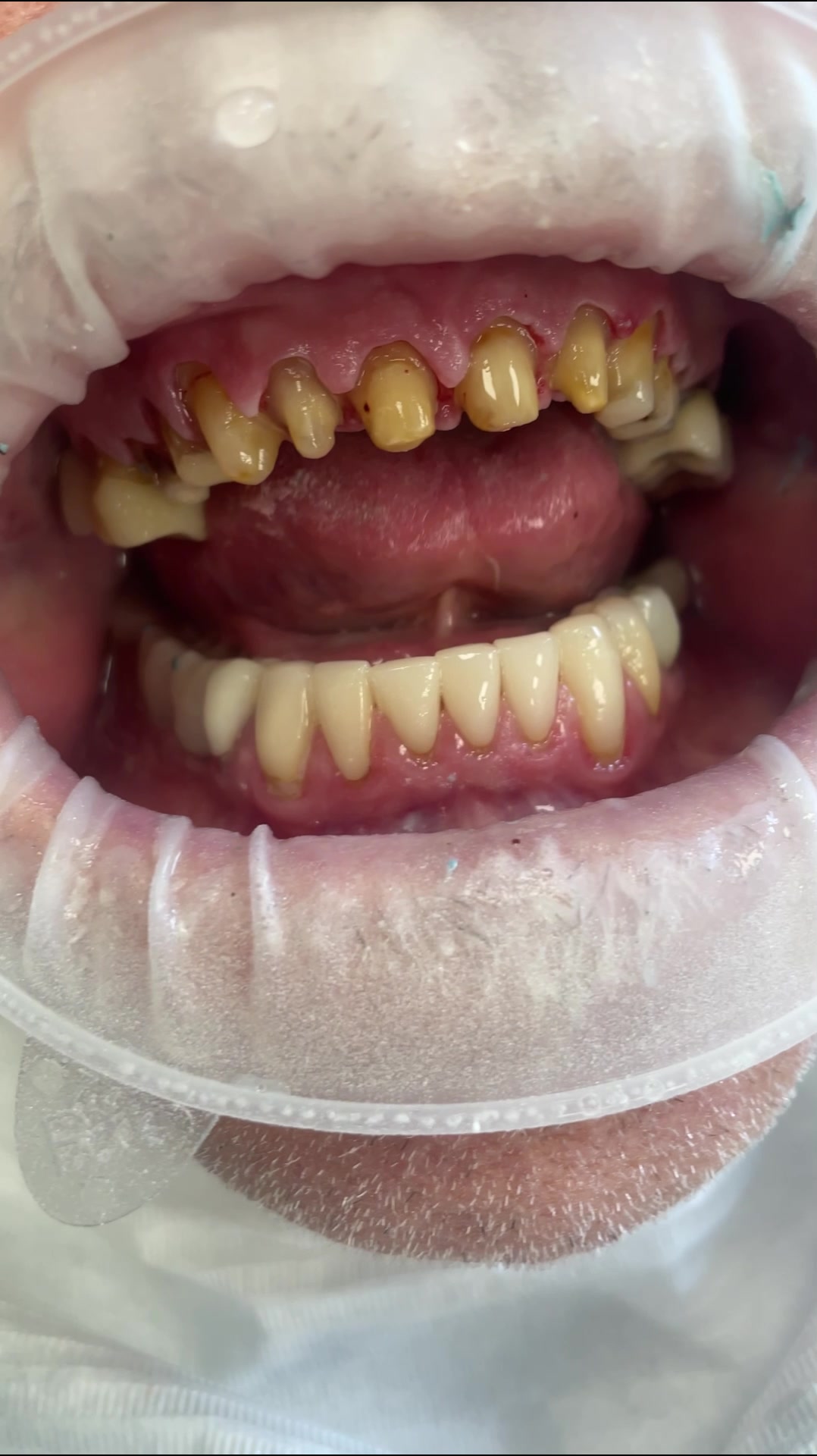 @DrWaldoEngelbrecht