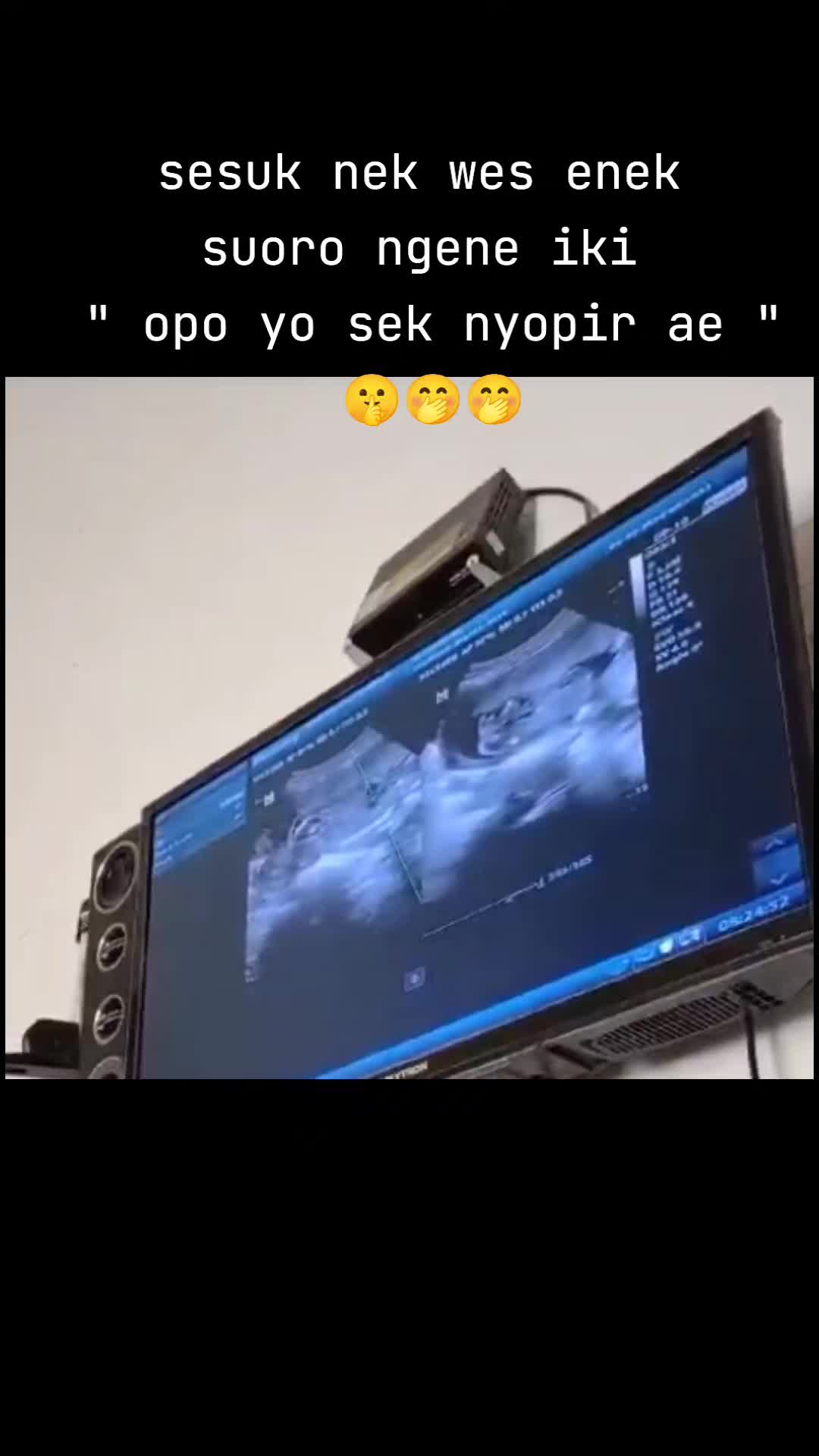 @M A N C A