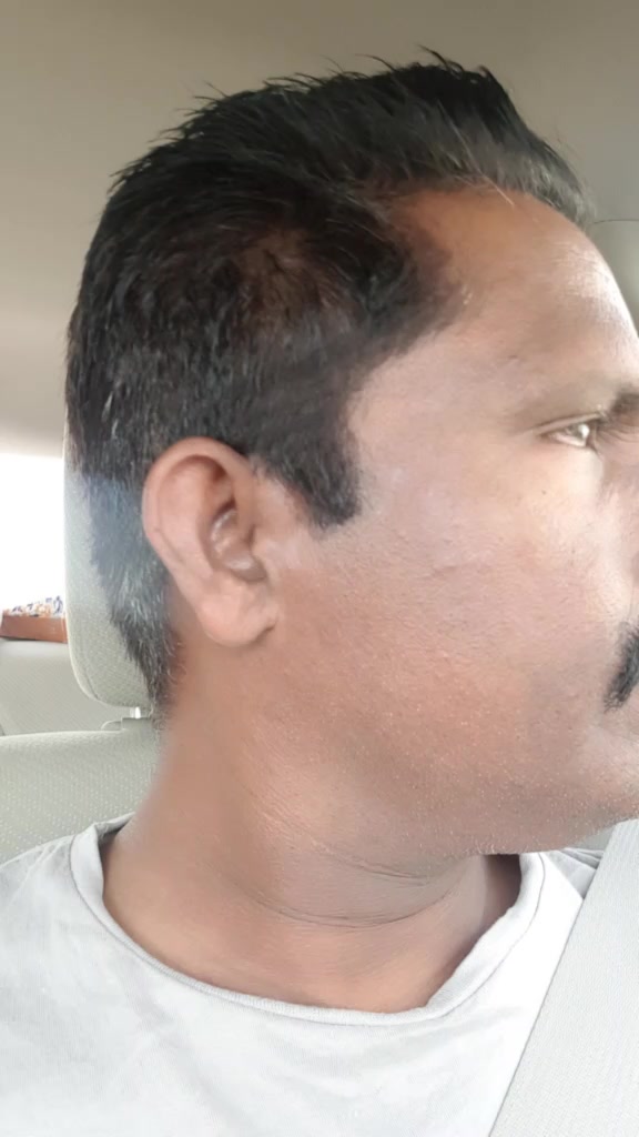 @anil punalur