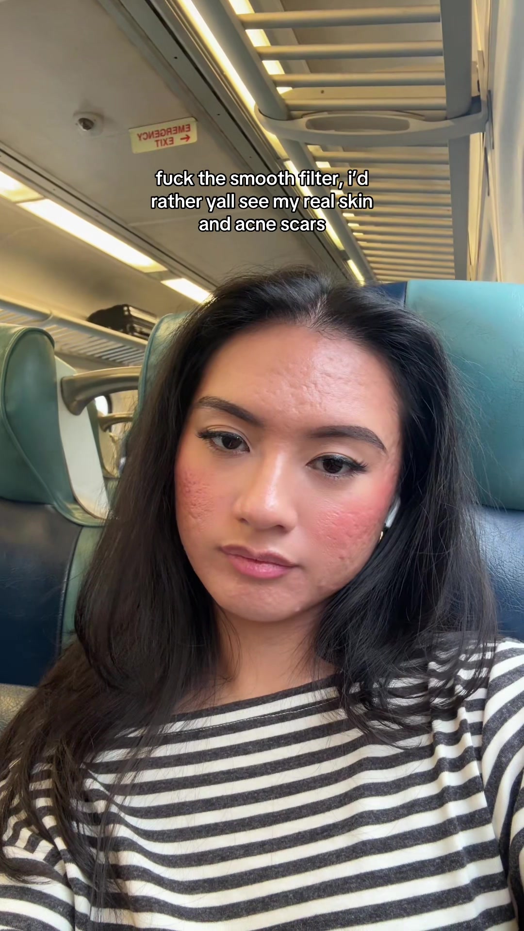@jennilee • thatacnegirlie