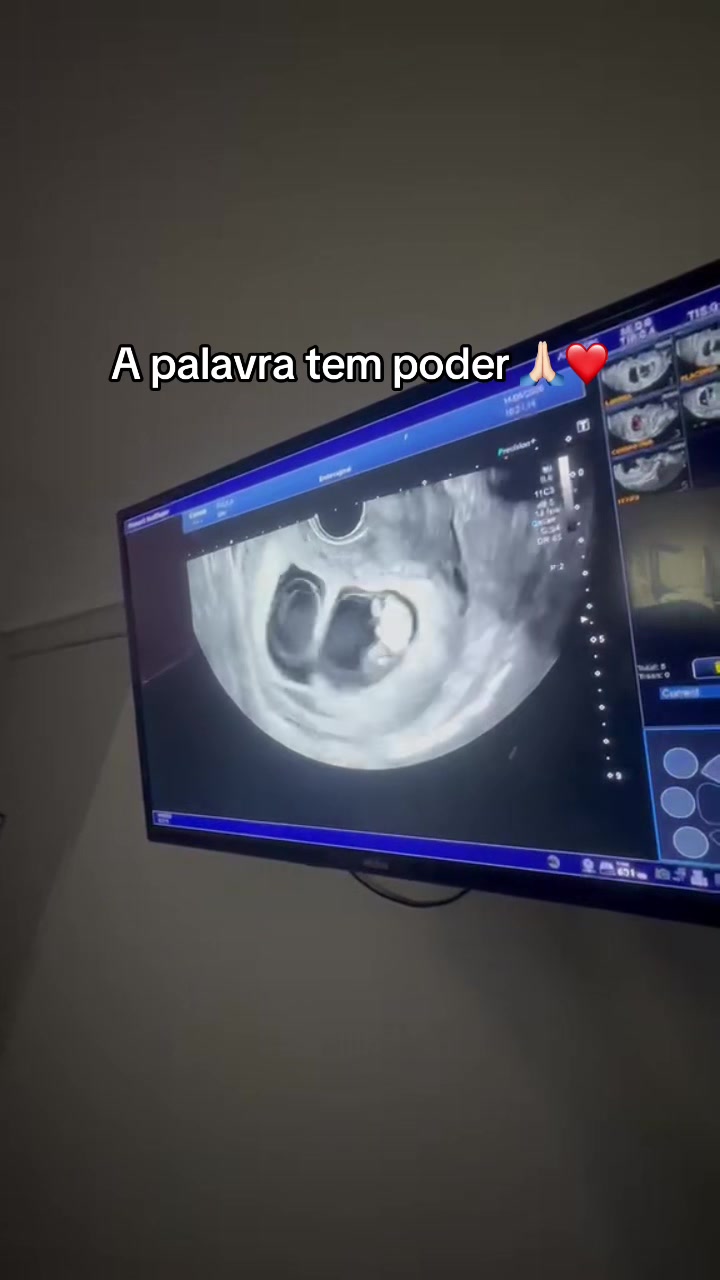 @Paula