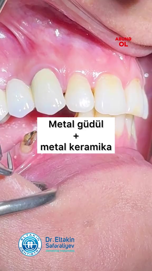 @eltakindentistry