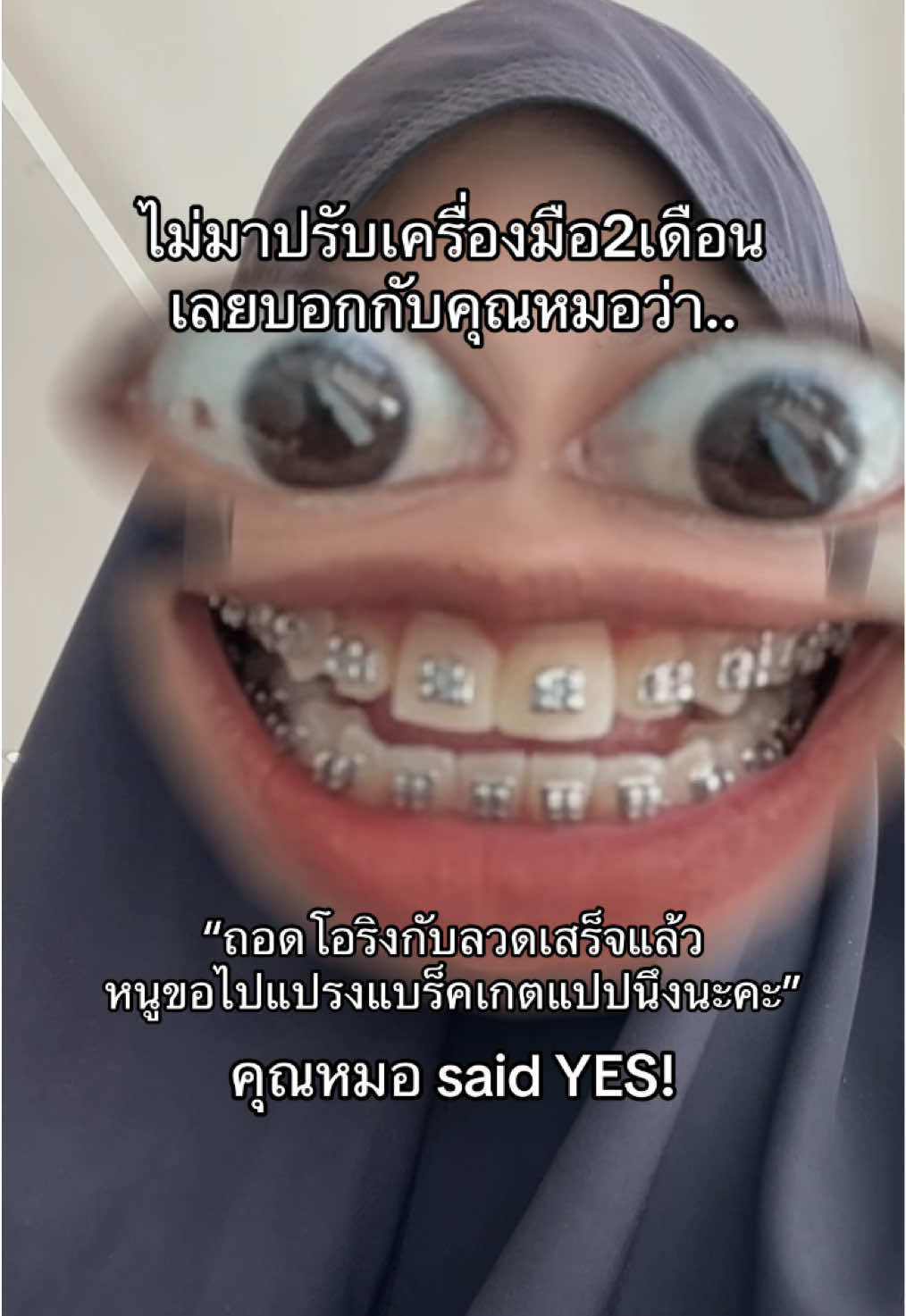 @ฟาตินฟันกระต่ายอ้ะะ🐰