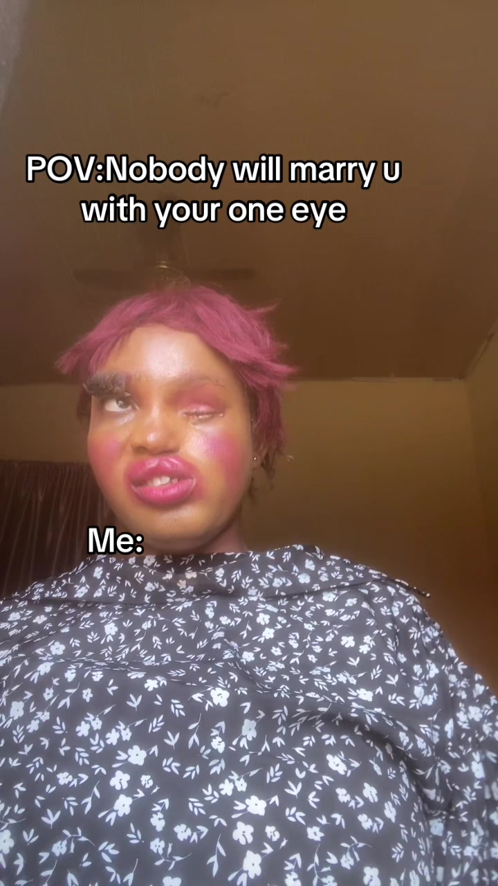 @OMA