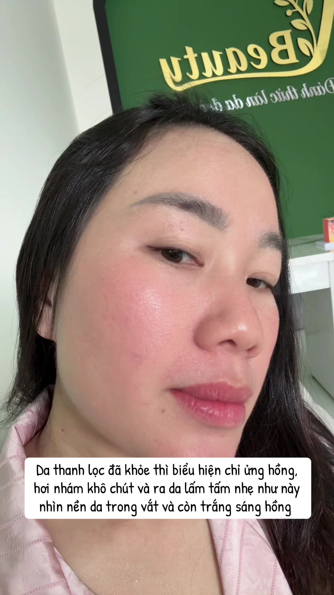 @Ho&agrave;ng Anh N Beauty