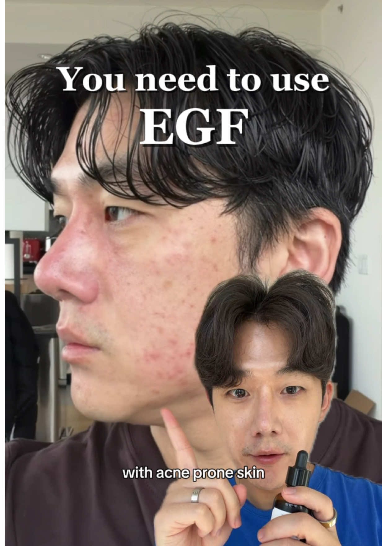 @Brute Choi 🧿