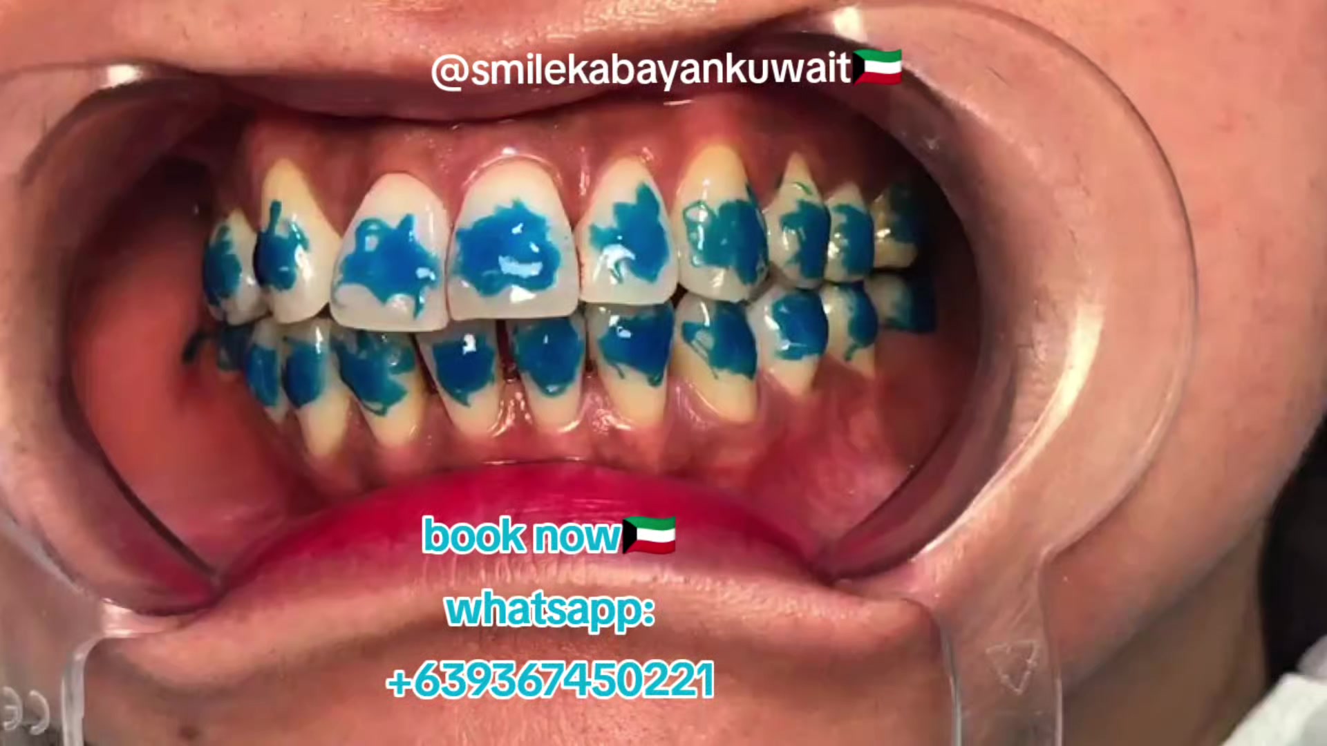 @SmileKabayanKuwait🇰🇼