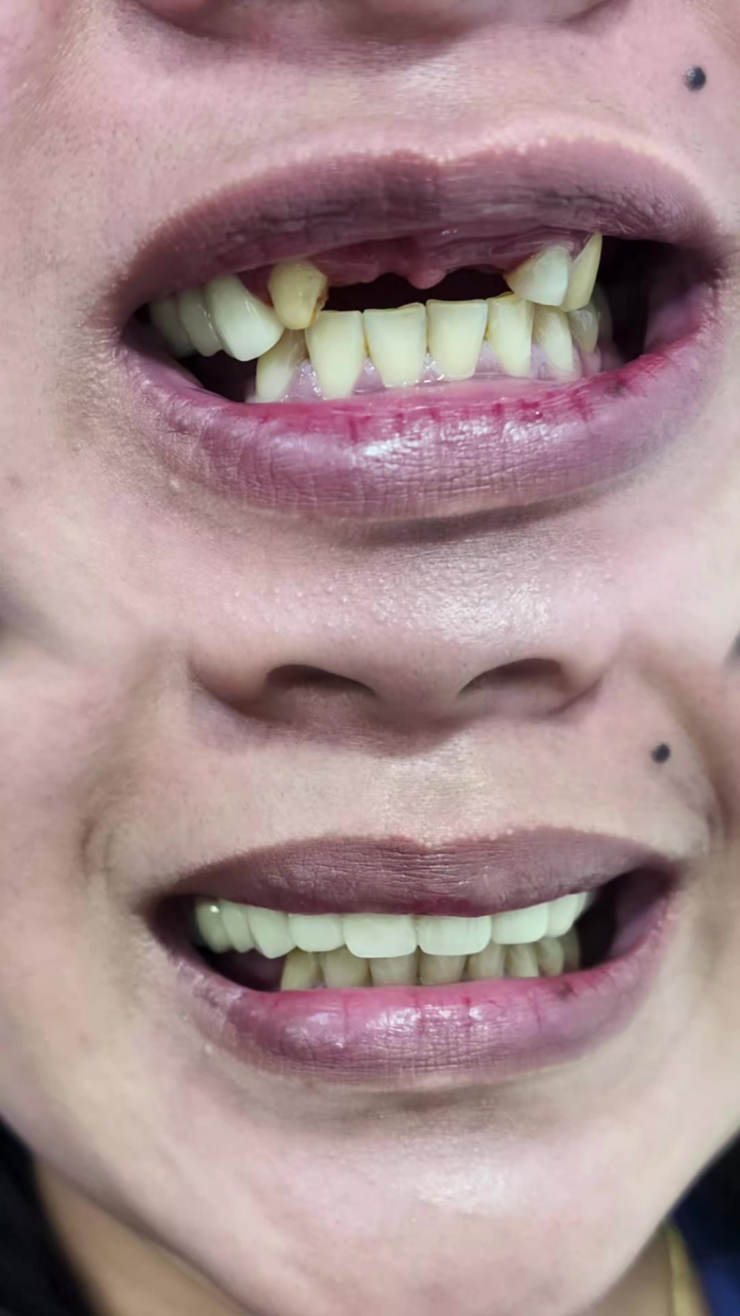 @Pearly Smile