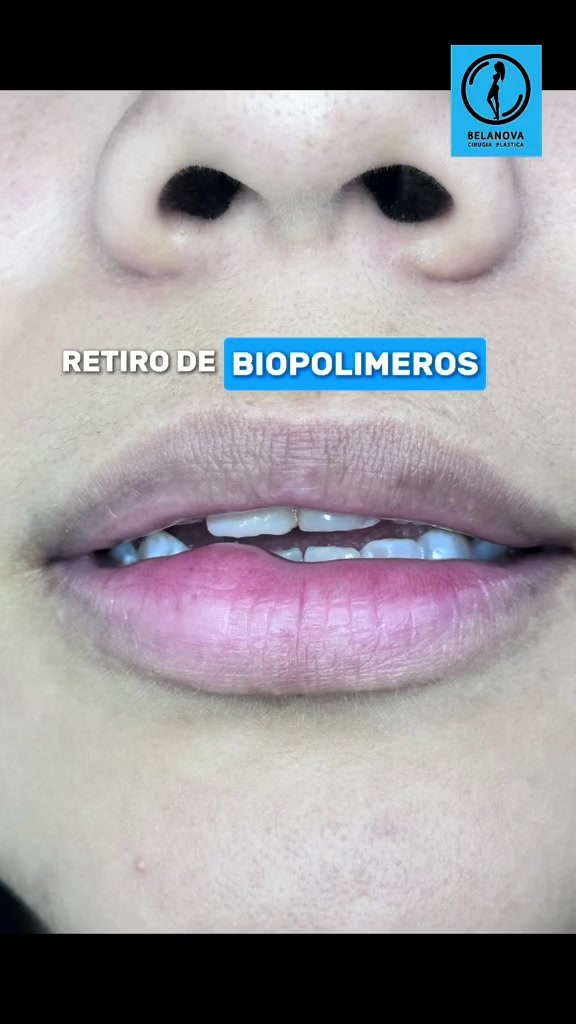@Belanovacirugiaplastica
