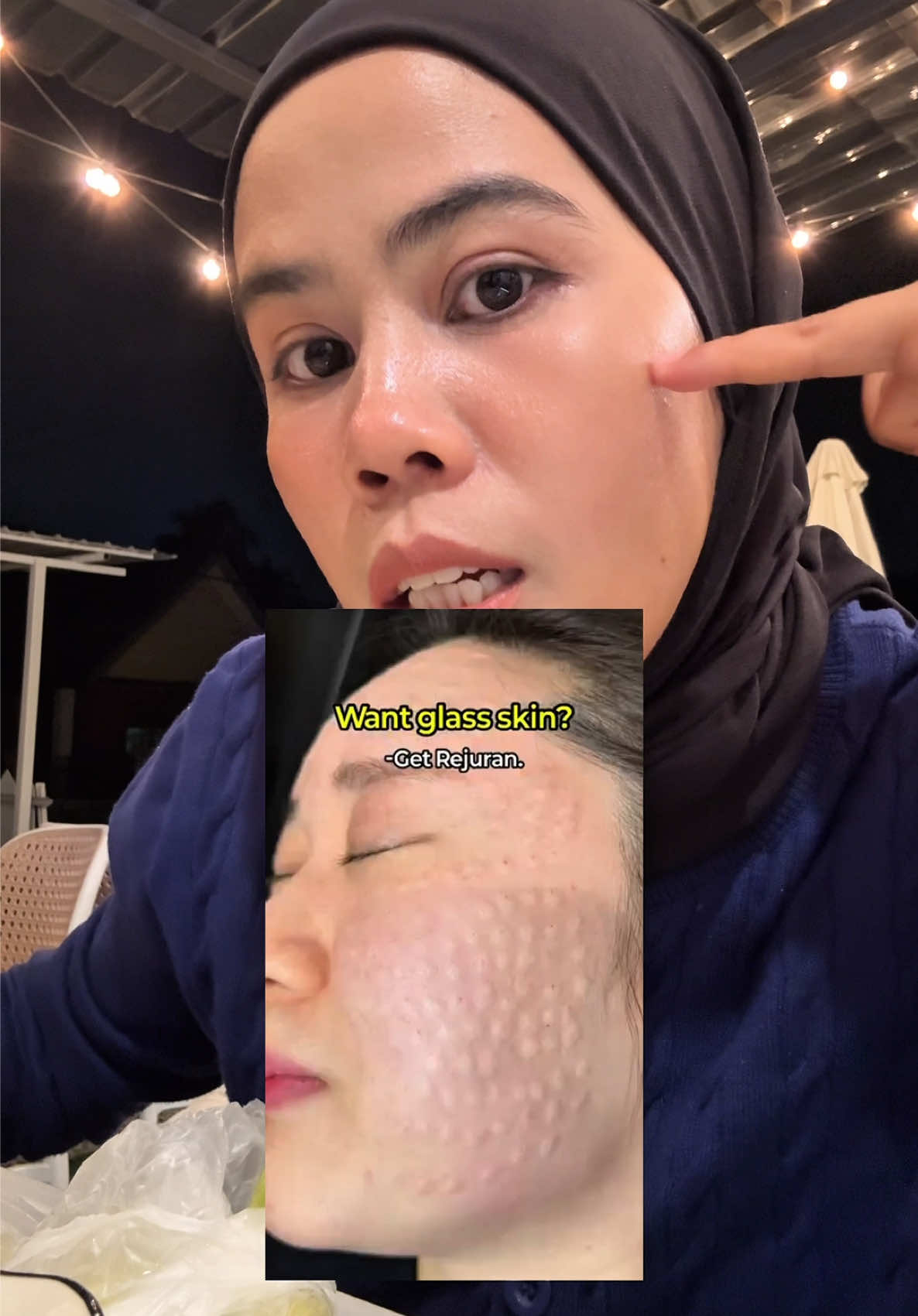 @Adila Ibrahim